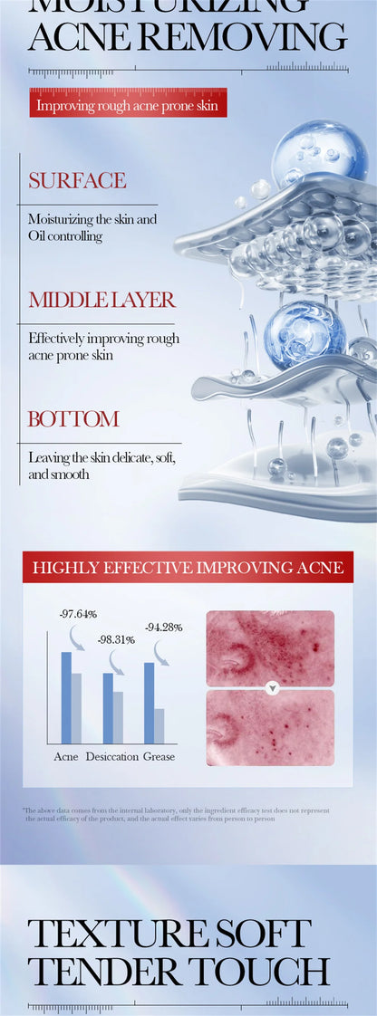 Salicylic Acid Acne Treatment Face Cream Repair Pimple Spots Deep Cleaning Pore Anti-acne Scar Oil Control Moisturizer Skin Care